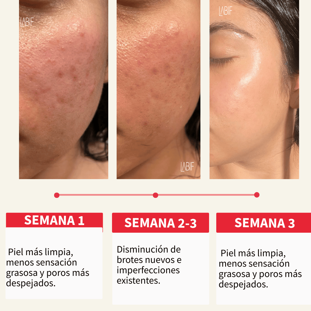 COMBO ANTI-IMPERFECCIONES + ENVIO GRATIS