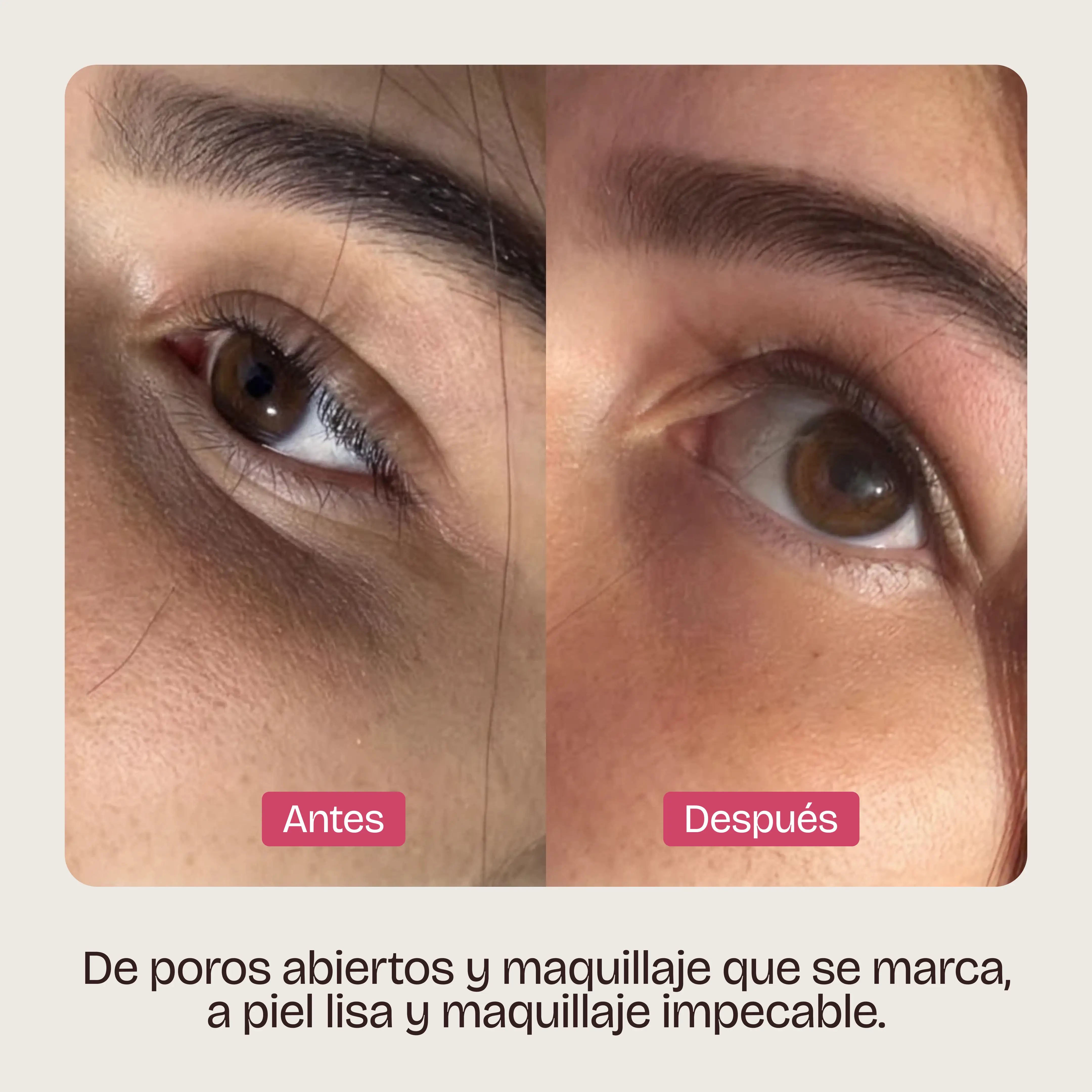 GEL DE RECUBRIMIENTO