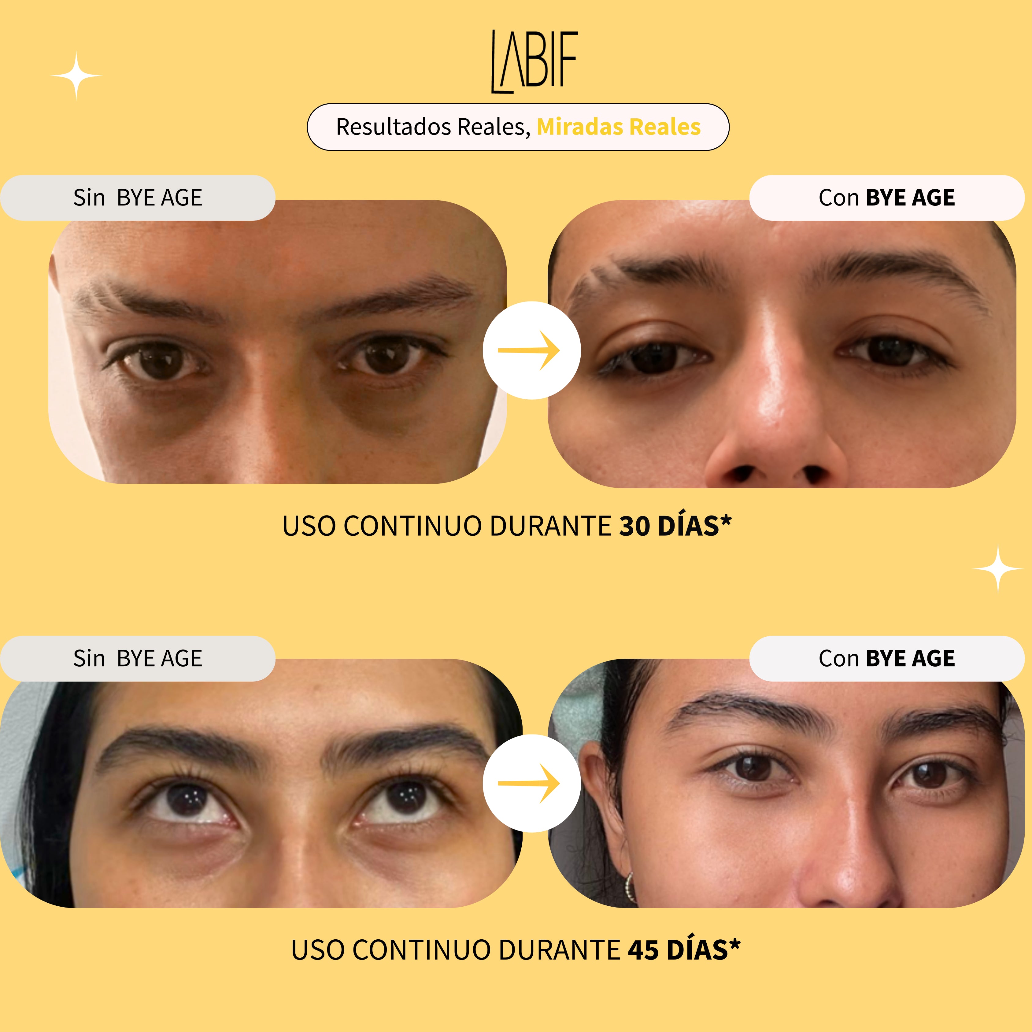 BYE AGE BANANA - ANTI OJERAS