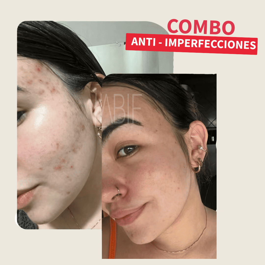 COMBO ANTI-IMPERFECCIONES + ENVIO GRATIS